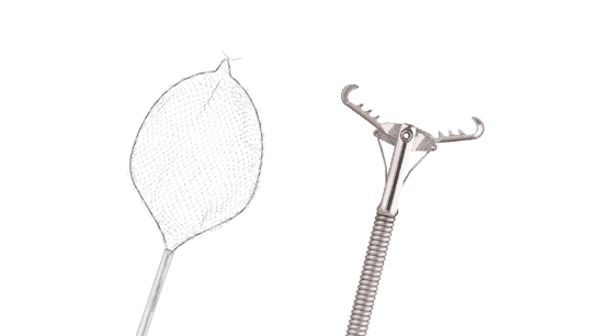 gestione-dei-corpi-estranei