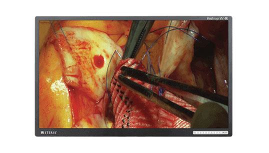 Monitores de pared Vividimage® W 4K