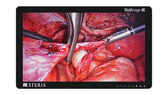 Vividimage™ 4K Surgical Display