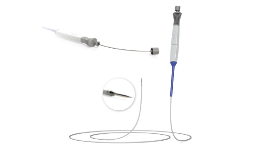 Balloon Extraction Foreign Body Removal | STERIS United Kingdom